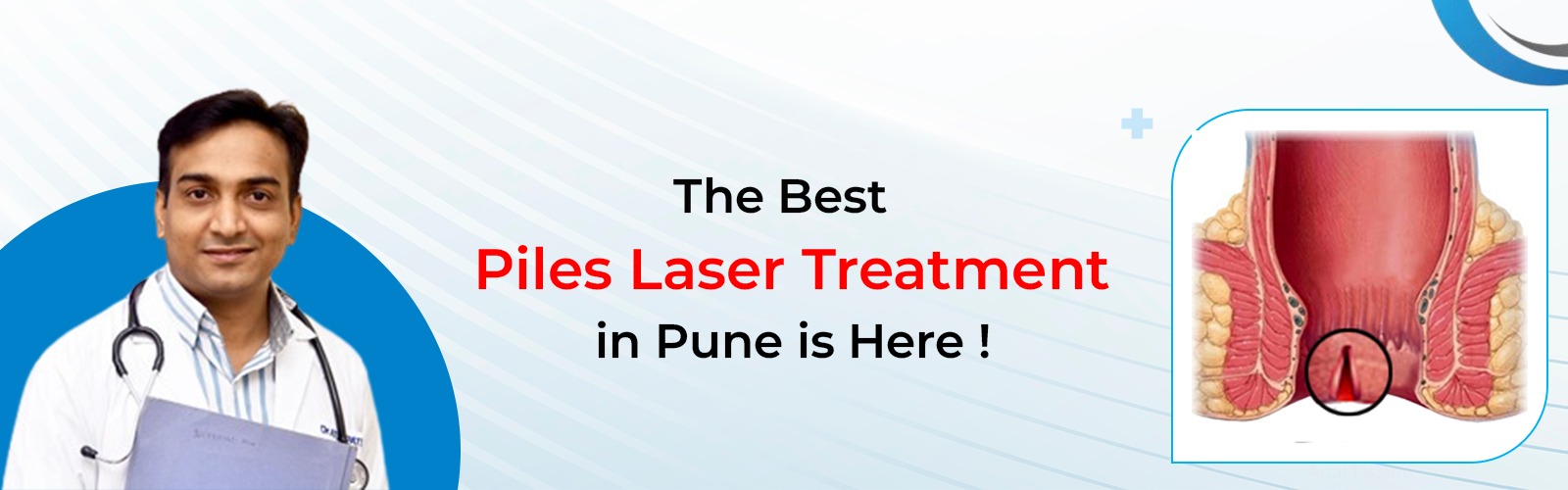 laser surgery treatment for fissure vithai piles hospital pune