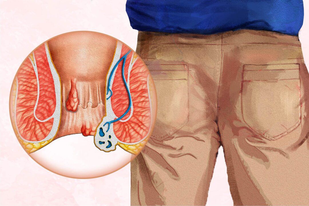perianal abscess symptoms vithai piles clinic in pune