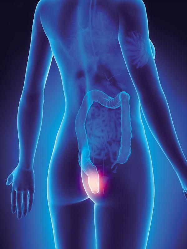 Perianal Abscess Treatment Vithai Piles Hospital Pune