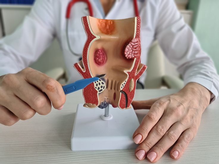 What Does a Proctologist Do - Vithai Piles Clinic Pune