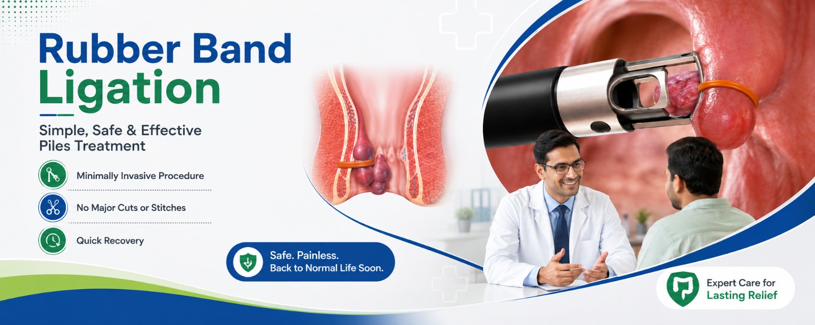 Fissure treatment