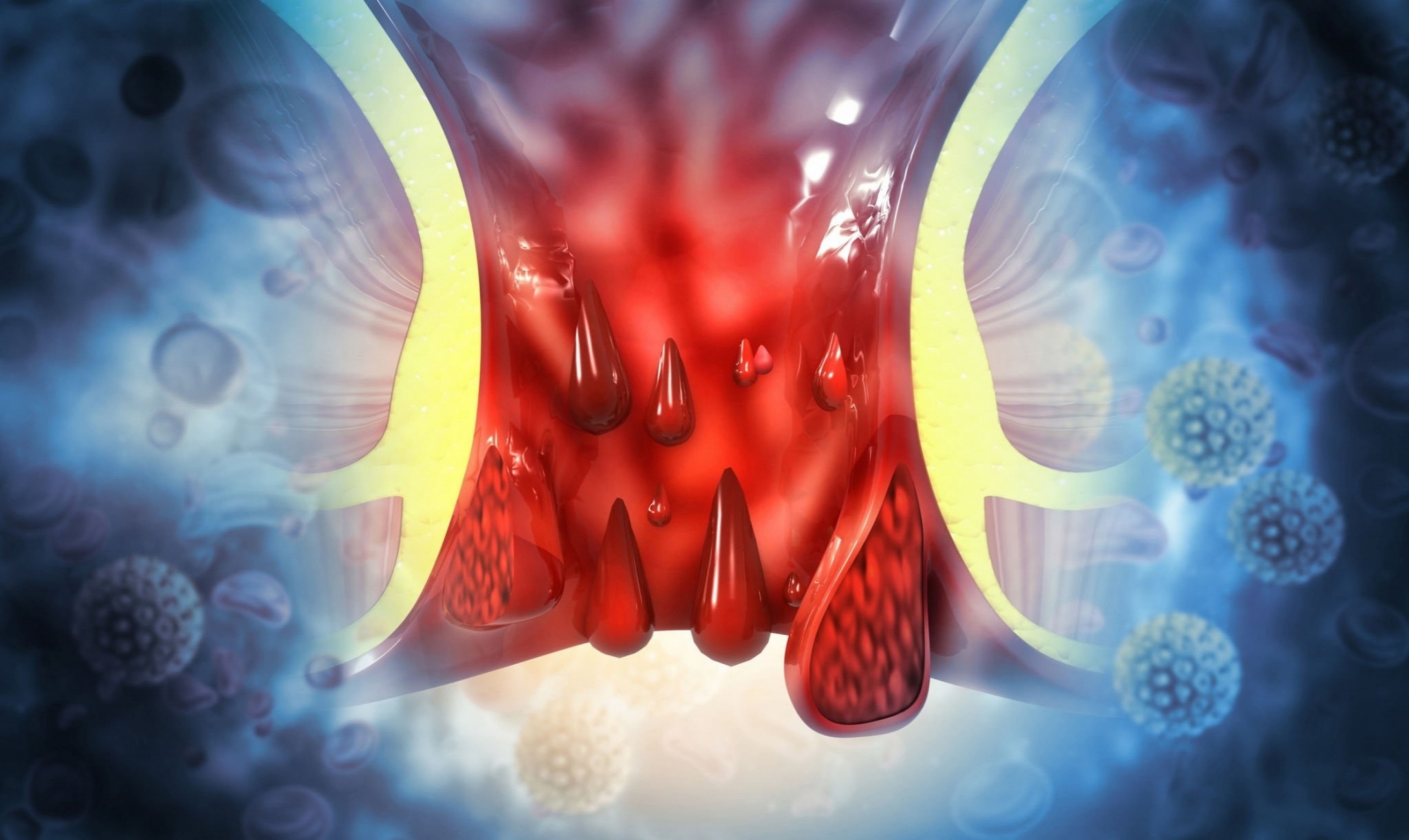 laser treatment for fissure vithai piles clinic in kalewadi pimpri chinchwad 